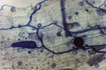 Banana root cells showing mycorrhizal hyphae stained in blue